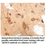 ARMC8 Antibody from Signalway Antibody (39861) - Antibodies.com