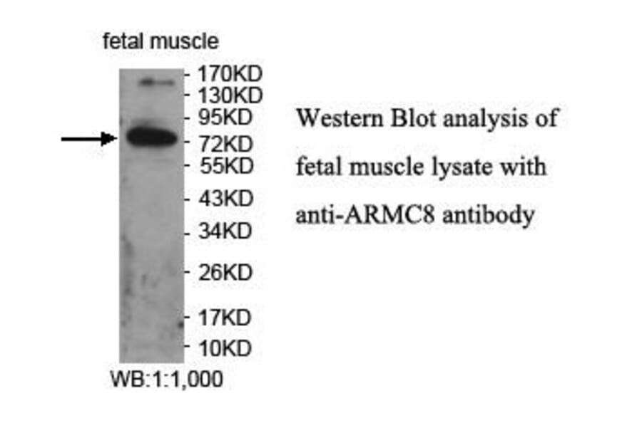 ARMC8 Antibody from Signalway Antibody (39861) - Antibodies.com