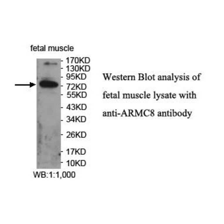 ARMC8 Antibody from Signalway Antibody (39861) - Antibodies.com