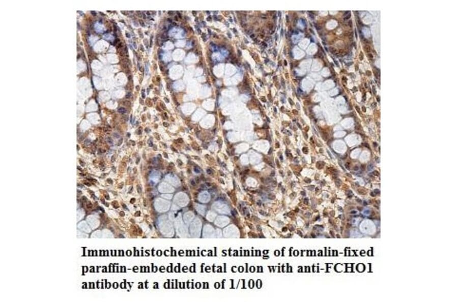 FCHO1 Antibody from Signalway Antibody (39866) - Antibodies.com