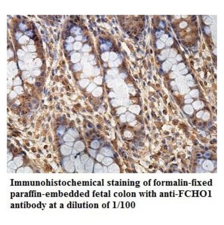 FCHO1 Antibody from Signalway Antibody (39866) - Antibodies.com