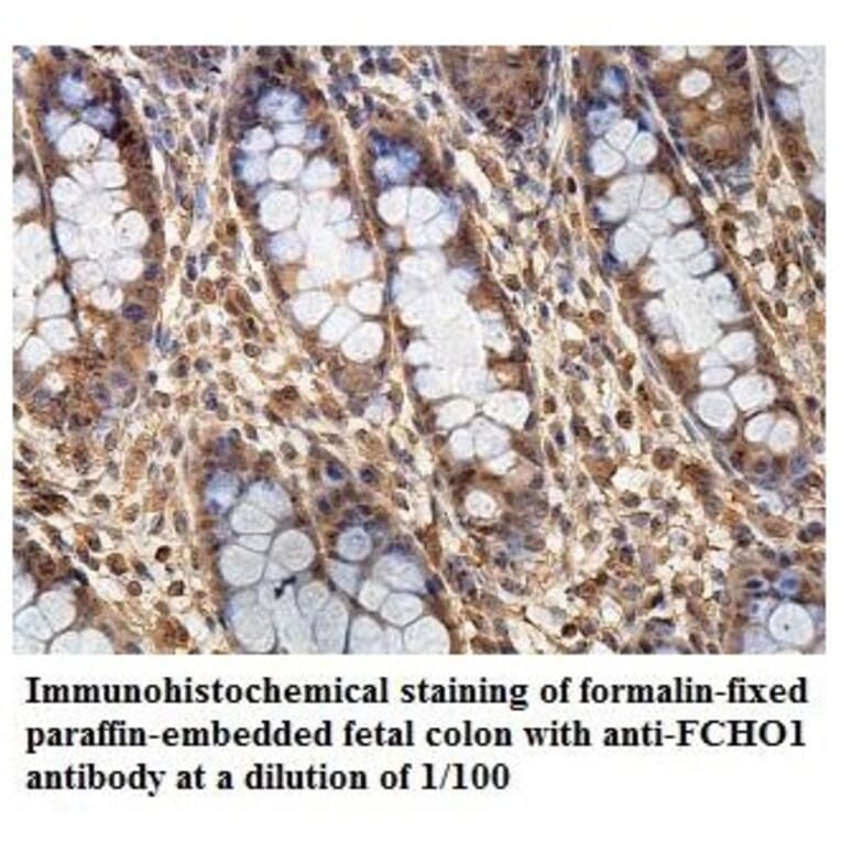 FCHO1 Antibody from Signalway Antibody (39866) - Antibodies.com