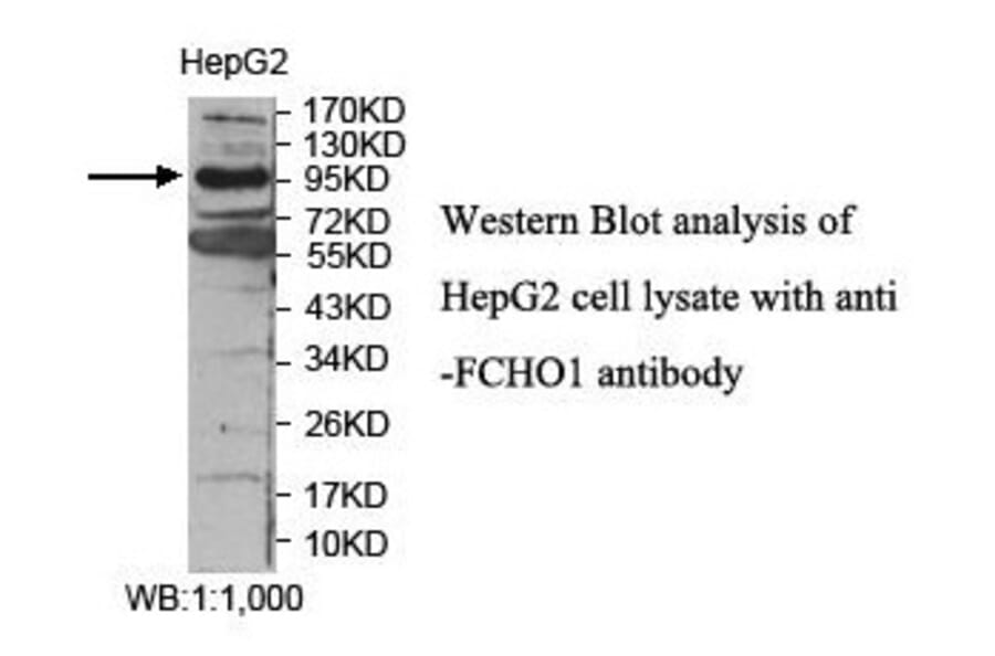 FCHO1 Antibody from Signalway Antibody (39866) - Antibodies.com