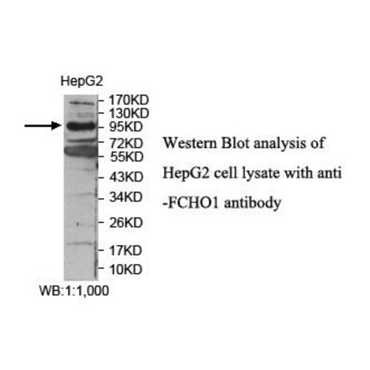 FCHO1 Antibody from Signalway Antibody (39866) - Antibodies.com