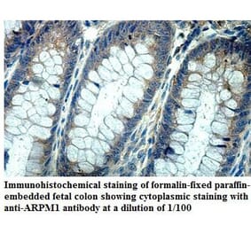 ARPM1 Antibody from Signalway Antibody (39867) - Antibodies.com