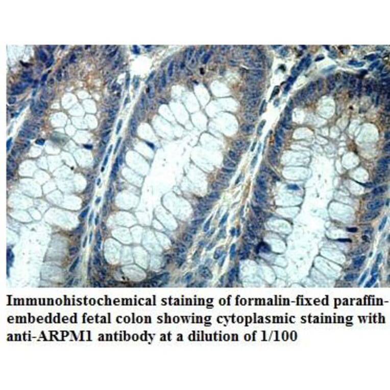 ARPM1 Antibody from Signalway Antibody (39867) - Antibodies.com
