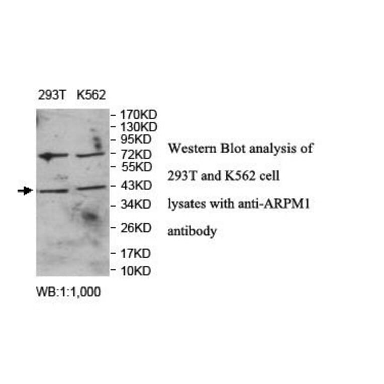 ARPM1 Antibody from Signalway Antibody (39867) - Antibodies.com