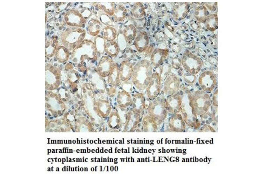 LENG8 Antibody from Signalway Antibody (39875) - Antibodies.com