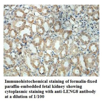 LENG8 Antibody from Signalway Antibody (39875) - Antibodies.com