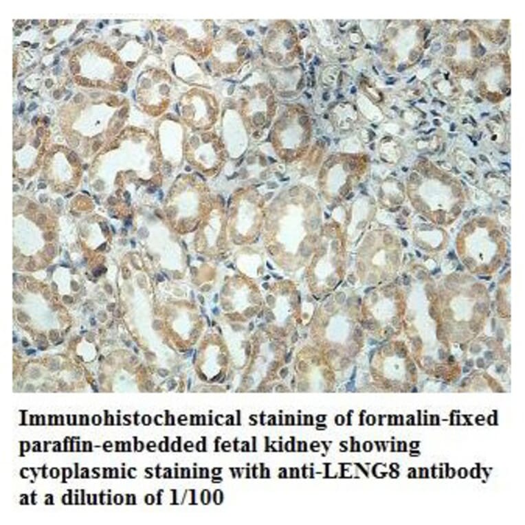 LENG8 Antibody from Signalway Antibody (39875) - Antibodies.com