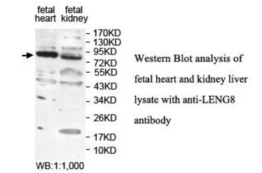LENG8 Antibody from Signalway Antibody (39875) - Antibodies.com