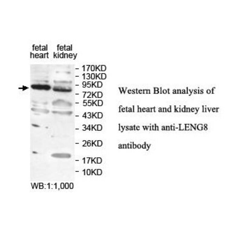LENG8 Antibody from Signalway Antibody (39875) - Antibodies.com