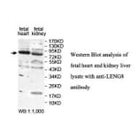 LENG8 Antibody from Signalway Antibody (39875) - Antibodies.com