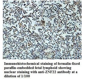 ZNF22 Antibody from Signalway Antibody (39881) - Antibodies.com