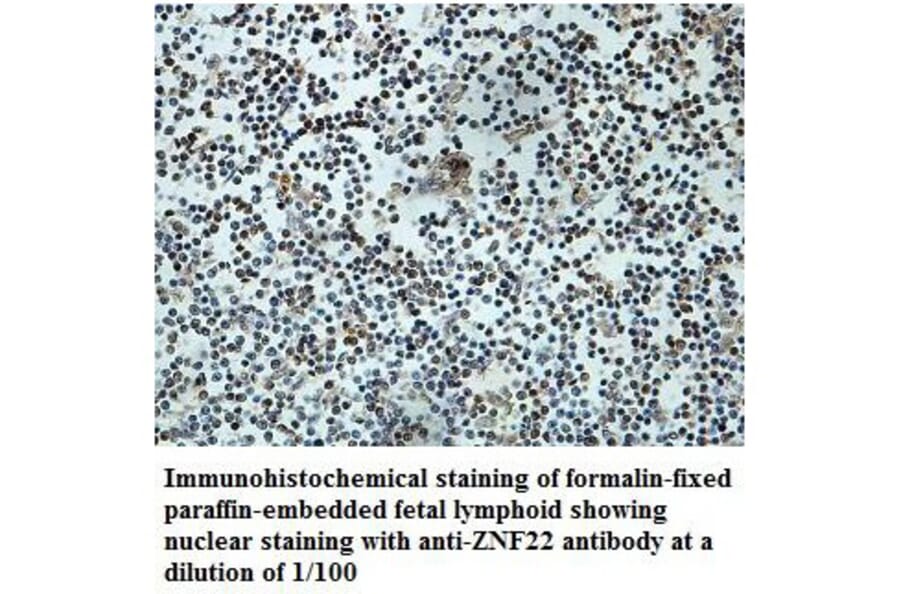 ZNF22 Antibody from Signalway Antibody (39881) - Antibodies.com