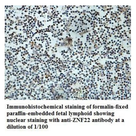 ZNF22 Antibody from Signalway Antibody (39881) - Antibodies.com