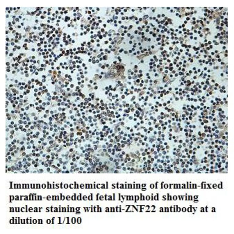 ZNF22 Antibody from Signalway Antibody (39881) - Antibodies.com