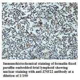 ZNF22 Antibody from Signalway Antibody (39881) - Antibodies.com