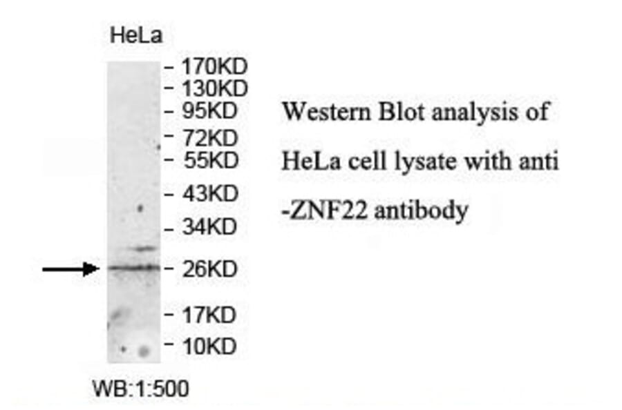 ZNF22 Antibody from Signalway Antibody (39881) - Antibodies.com