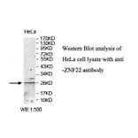 ZNF22 Antibody from Signalway Antibody (39881) - Antibodies.com