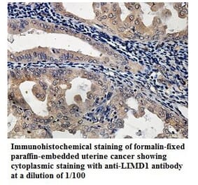 LIMD1 Antibody from Signalway Antibody (39892) - Antibodies.com