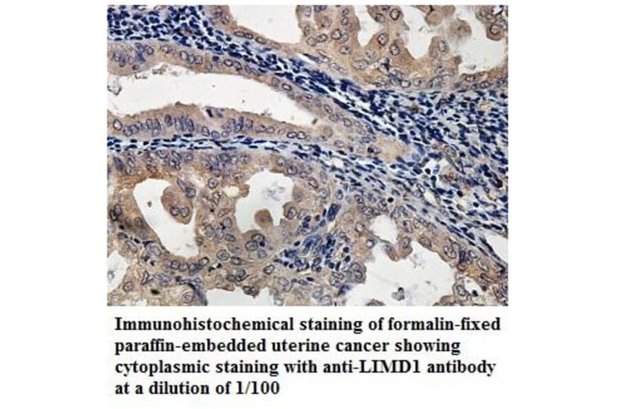 LIMD1 Antibody from Signalway Antibody (39892) - Antibodies.com