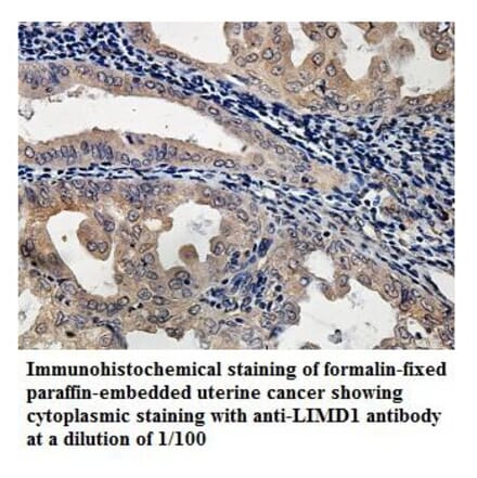 LIMD1 Antibody from Signalway Antibody (39892) - Antibodies.com