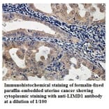 LIMD1 Antibody from Signalway Antibody (39892) - Antibodies.com