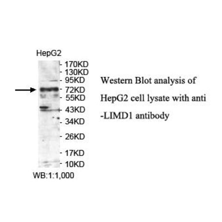 LIMD1 Antibody from Signalway Antibody (39892) - Antibodies.com