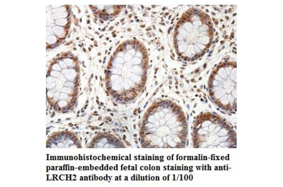LRCH2 Antibody from Signalway Antibody (39895) - Antibodies.com
