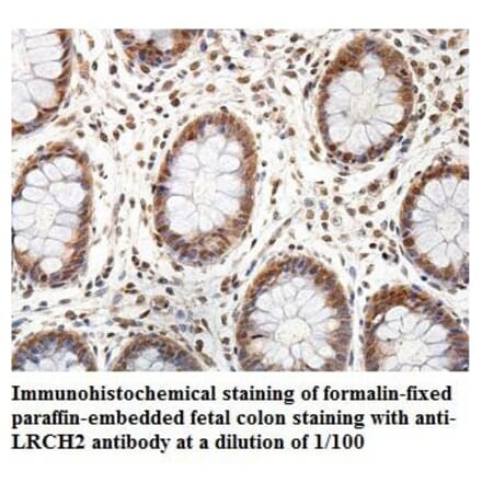 LRCH2 Antibody from Signalway Antibody (39895) - Antibodies.com