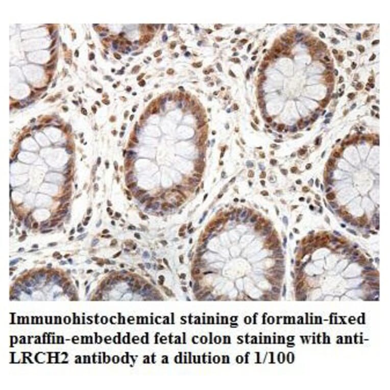 LRCH2 Antibody from Signalway Antibody (39895) - Antibodies.com