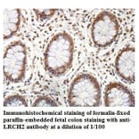LRCH2 Antibody from Signalway Antibody (39895) - Antibodies.com