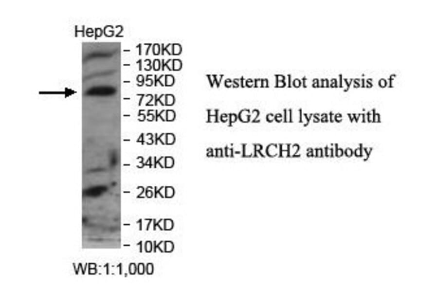 LRCH2 Antibody from Signalway Antibody (39895) - Antibodies.com