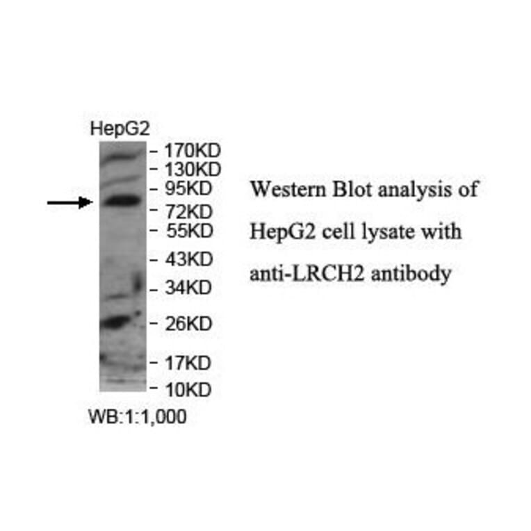 LRCH2 Antibody from Signalway Antibody (39895) - Antibodies.com