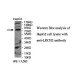 LRCH2 Antibody from Signalway Antibody (39895) - Antibodies.com