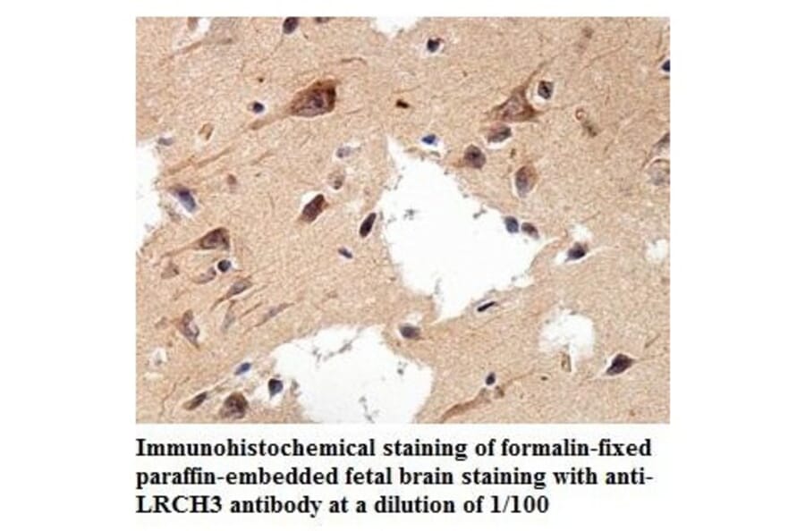 LRCH3 Antibody from Signalway Antibody (39896) - Antibodies.com