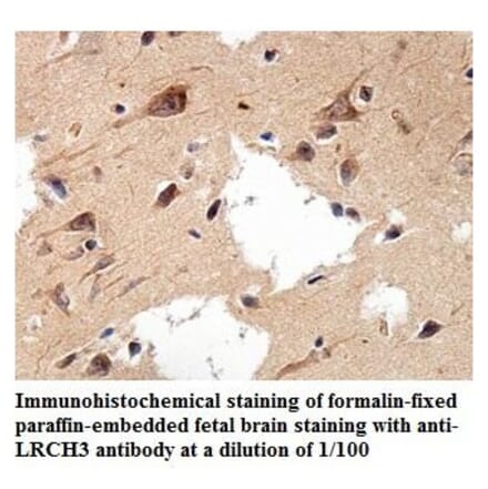 LRCH3 Antibody from Signalway Antibody (39896) - Antibodies.com
