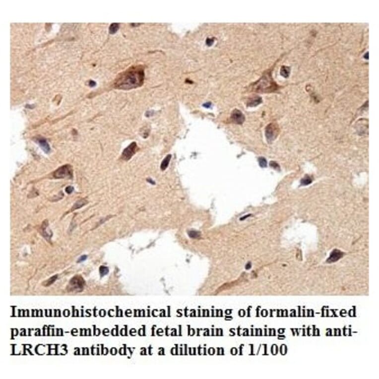 LRCH3 Antibody from Signalway Antibody (39896) - Antibodies.com