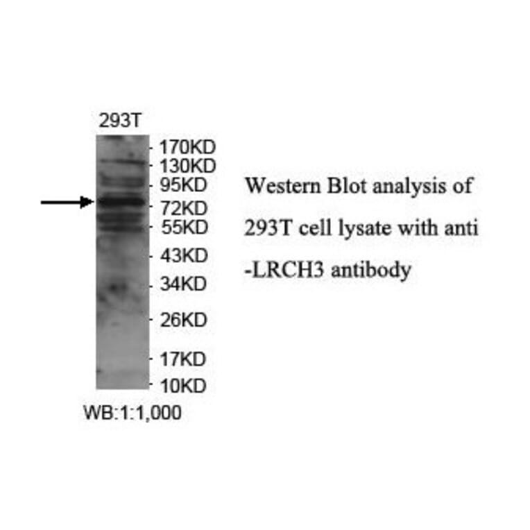 LRCH3 Antibody from Signalway Antibody (39896) - Antibodies.com