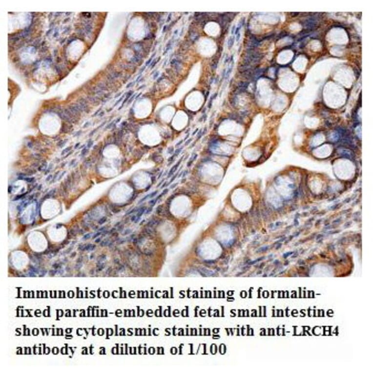 LRCH4 Antibody from Signalway Antibody (39897) - Antibodies.com