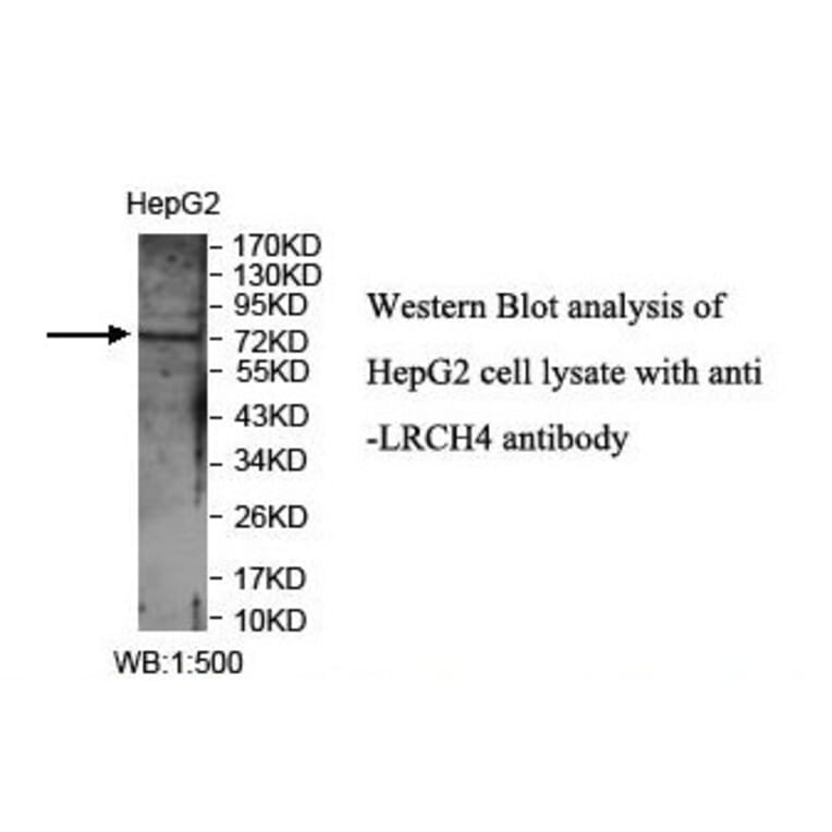 LRCH4 Antibody from Signalway Antibody (39897) - Antibodies.com