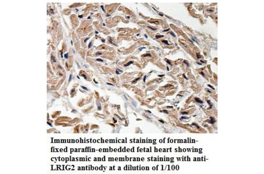 LRIG2 Antibody from Signalway Antibody (39898) - Antibodies.com