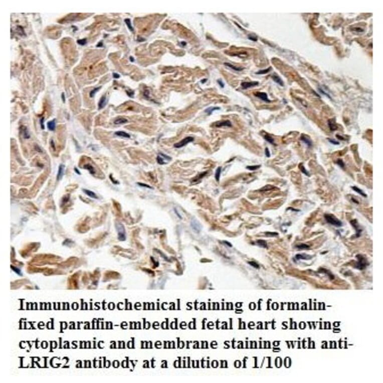 LRIG2 Antibody from Signalway Antibody (39898) - Antibodies.com