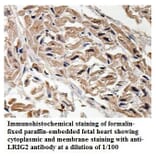 LRIG2 Antibody from Signalway Antibody (39898) - Antibodies.com