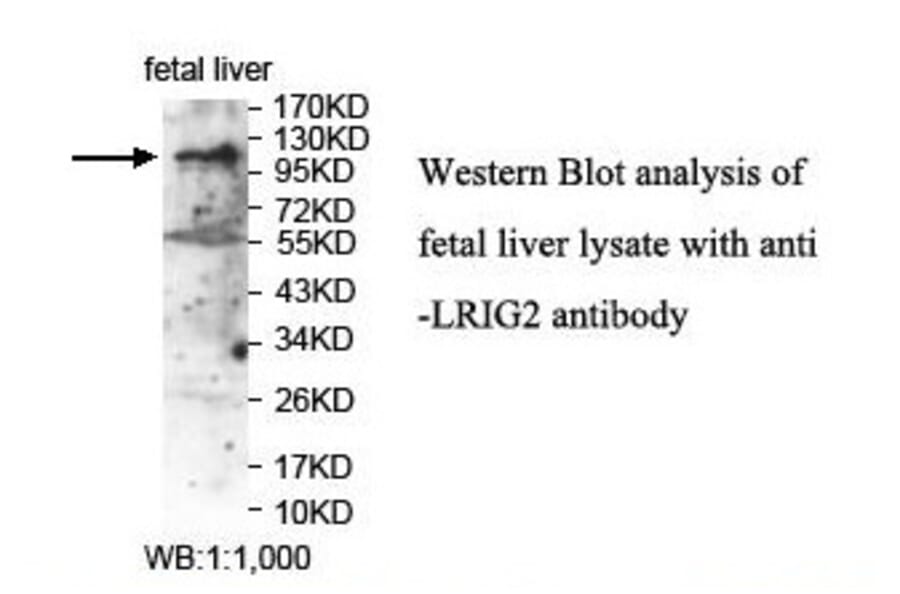 LRIG2 Antibody from Signalway Antibody (39898) - Antibodies.com