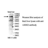 LRIG2 Antibody from Signalway Antibody (39898) - Antibodies.com