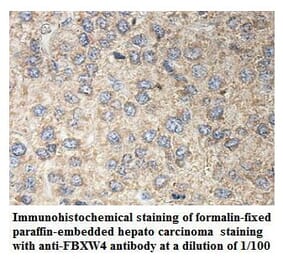 FBXW4 Antibody from Signalway Antibody (39899) - Antibodies.com