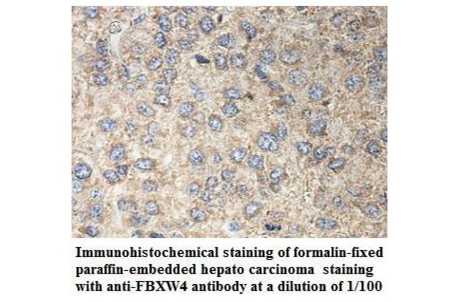 FBXW4 Antibody from Signalway Antibody (39899) - Antibodies.com