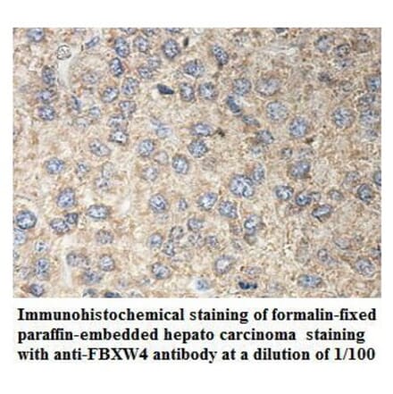 FBXW4 Antibody from Signalway Antibody (39899) - Antibodies.com